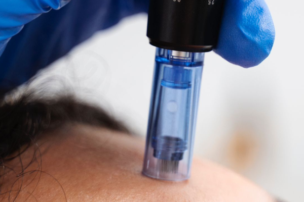 DermaPen + Vitaminas